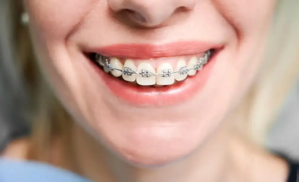 7 Simple Tips to Maintain Healthy Teeth and Gums